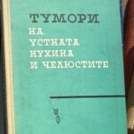 Тумори на устната кухина и челюстите