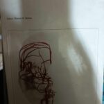 Migraine and related headaches