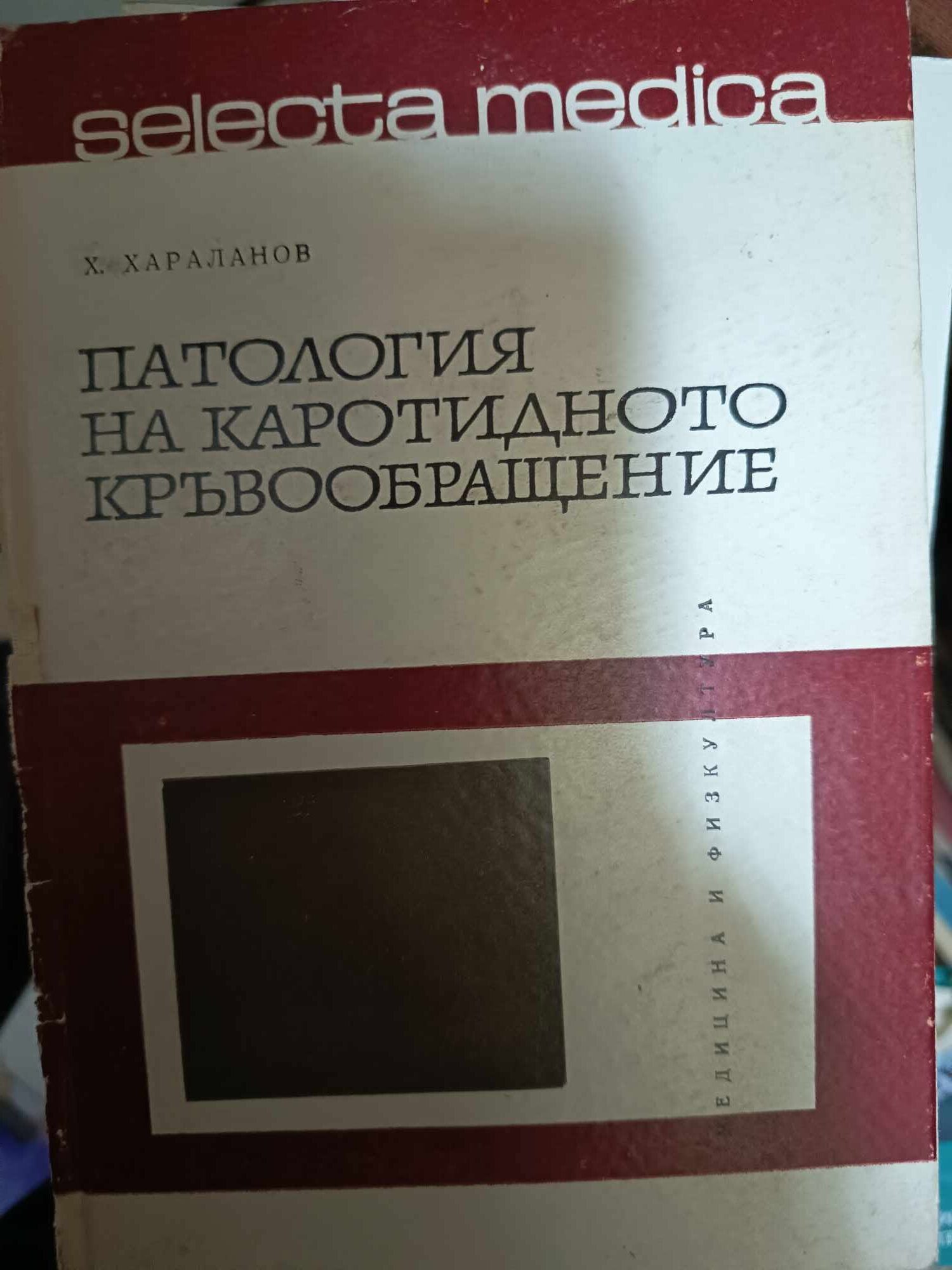 a109 Патология при каротидното кръвообращение - Image 1