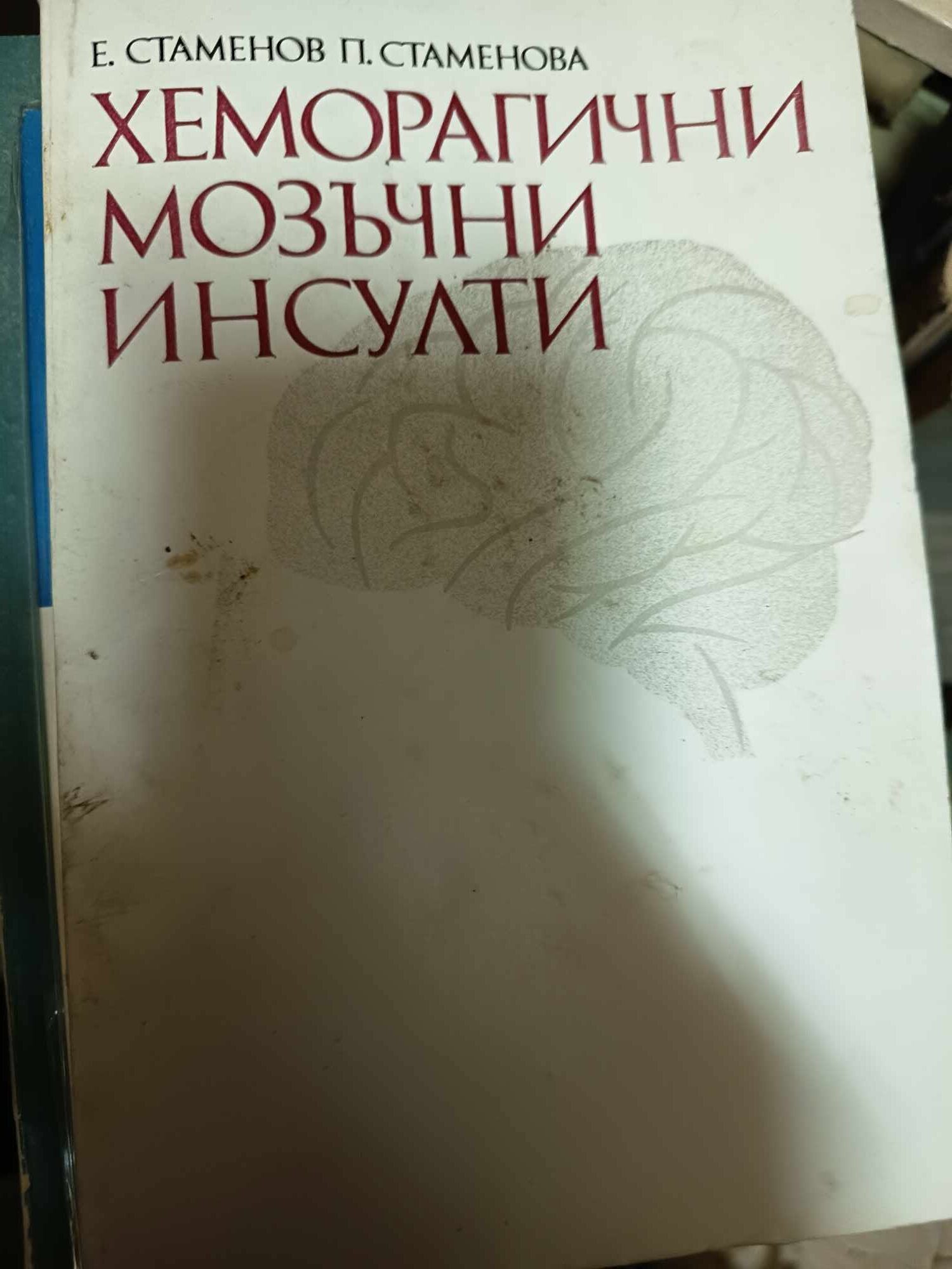 a12 Хеморагични мозъчни инсулти - Image 1