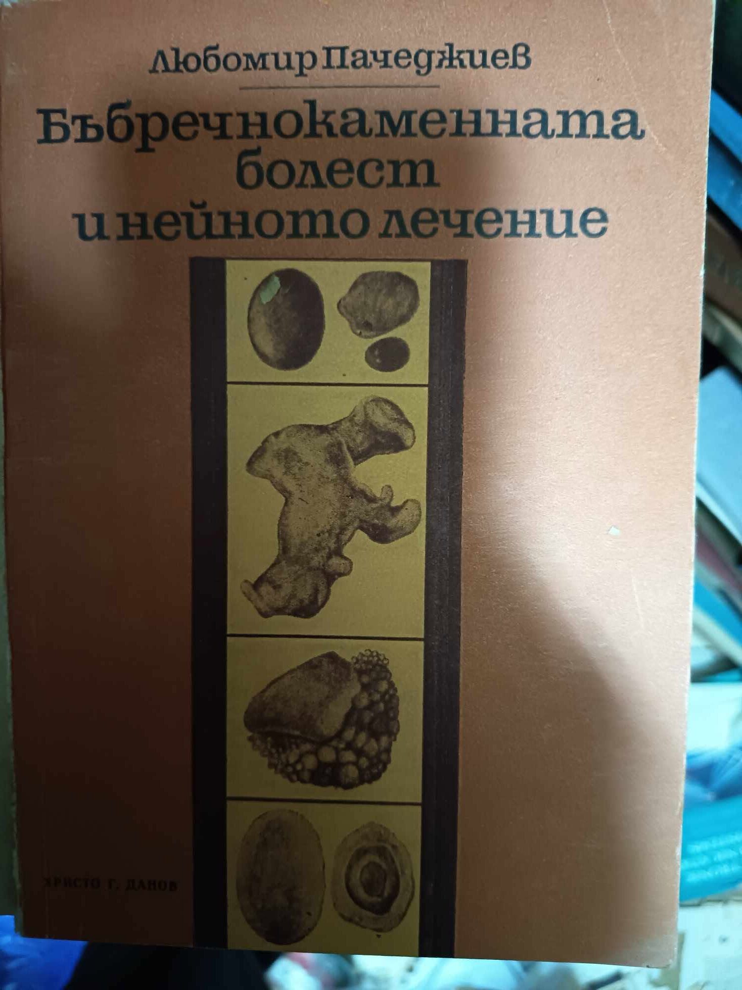 a121 Бъбречнокаменната болест и нейното лечение - Image 1