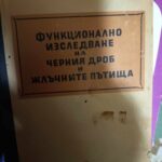 Функционално изследване на черния дроб и жлъчните пътища