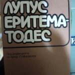 Лупус еритематодес